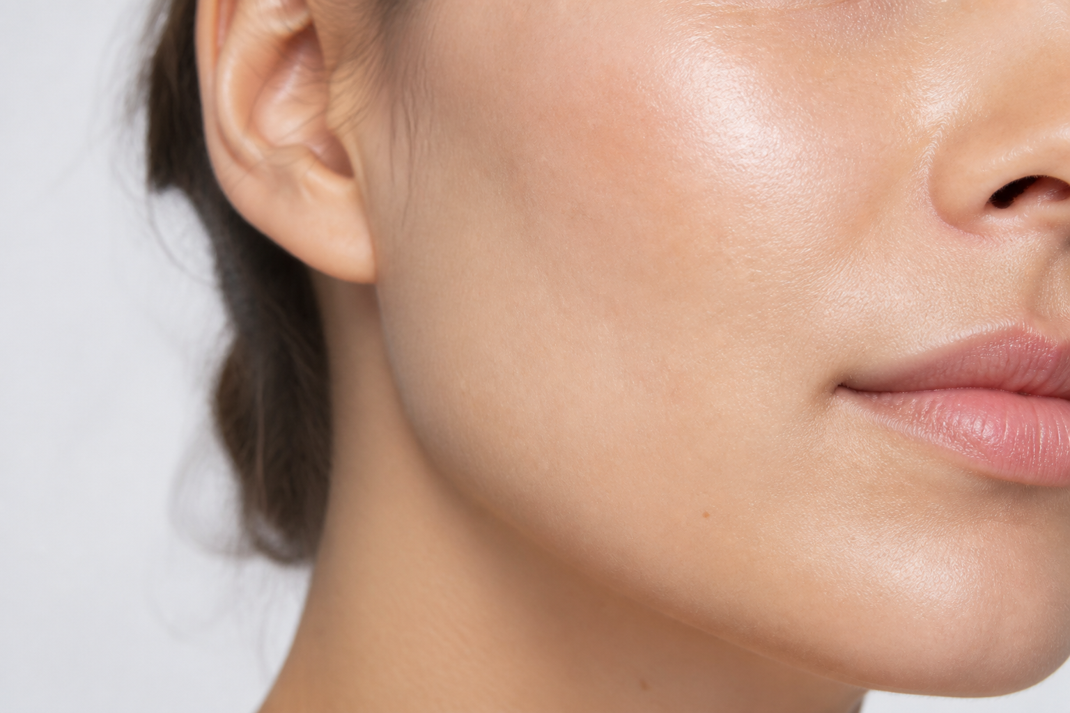 Acne scar treatment options at AB Skin Clinic Hyderabad